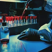 Renal Blood & Urine Tests